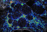 Science：花费近20年时间，破解线粒体清除和替换过程的谜题