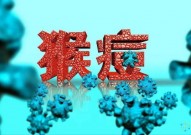 猴痘检测20-30 分钟出结果！上海巴斯德研究所等开发出新型检测方法
