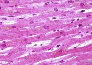 Cell Stem Cell：利用基因编辑阻止心肌细胞治疗造成的心律失常