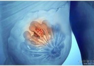 Nature子刊：乳腺肿瘤干细胞靶向治疗新突破！刘彩刚团队发现调控三阴性乳腺癌中ALDH+细胞新机制！