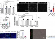 Nature子刊：诺如病毒通过一种意想不到的机制入侵胃肠道细胞！