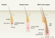 Nature：压力导致毛囊肿黑色素细胞干细胞使头发变白