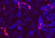 Science：癌症疫苗研究里程碑成果 个性化疫苗延缓癌症的复发