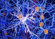 大脑免疫细胞“中毒”的关键在于血液中的某种成分