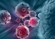 Cancer Cell：许琛琦/宋宝亮团队全面绘制肿瘤胆固醇代谢图谱，提升CAR-T治疗实体瘤效果