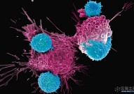Nature Cancer综述：肿瘤抗体靶向治疗进展