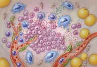 Cancer Cell：肿瘤中T细胞和B细胞组成“淋巴网”支持祖细胞的分化