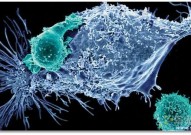 Nat Immunol：T细胞可从淋巴管迁出肿瘤并影响肿瘤免疫疗法