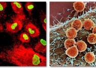 干细胞知识科普：免疫细胞与干细胞的区别