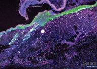 《Cell》一种全新却古老的伤口修复机制