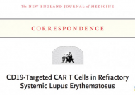 国内首个CAR-T细胞治疗系统性红斑狼疮临床试验获批，来自药明巨诺