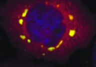 《细胞》封面：浙大和中科院解密让神经细胞生病的“小球”
