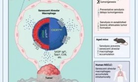 Cancer Cell挑战性新发现：衰老免疫细胞促进癌细胞生长！