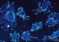 细胞焦亡与抗肿瘤免疫的关系，在癌症治疗中的应用前景