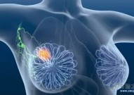 重大突破！厦门大学研究发现调节乳腺癌发展和耐药性的双重机制