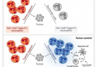 癌症的敌人还是盟友？Cell：揭秘机体中性粒细胞的双面人生！