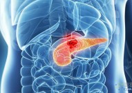 ​Science：表观遗传可塑性协同细胞互作关系胰腺癌发生