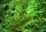 《Cell Stem Cell》陈跃军研究组揭示帕金森症细胞治疗策略，或有新进展