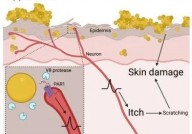 Cell：首次证明一种常见的皮肤细菌可以通过直接作用于神经细胞而引起瘙痒