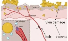 Cell：首次证明一种常见的皮肤细菌可以通过直接作用于神经细胞而引起瘙痒