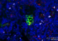 Nature发现一个以前未知的新机制：防止休眠的癌细胞从原发肿瘤中逃脱