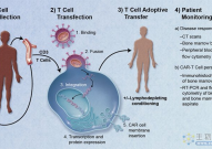 量身定制：如何为每个患者打造最佳CAR-T细胞疗法产品？