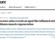 Nature：衰老细胞会终生损害身体，去除衰老细胞有助于抗衰老